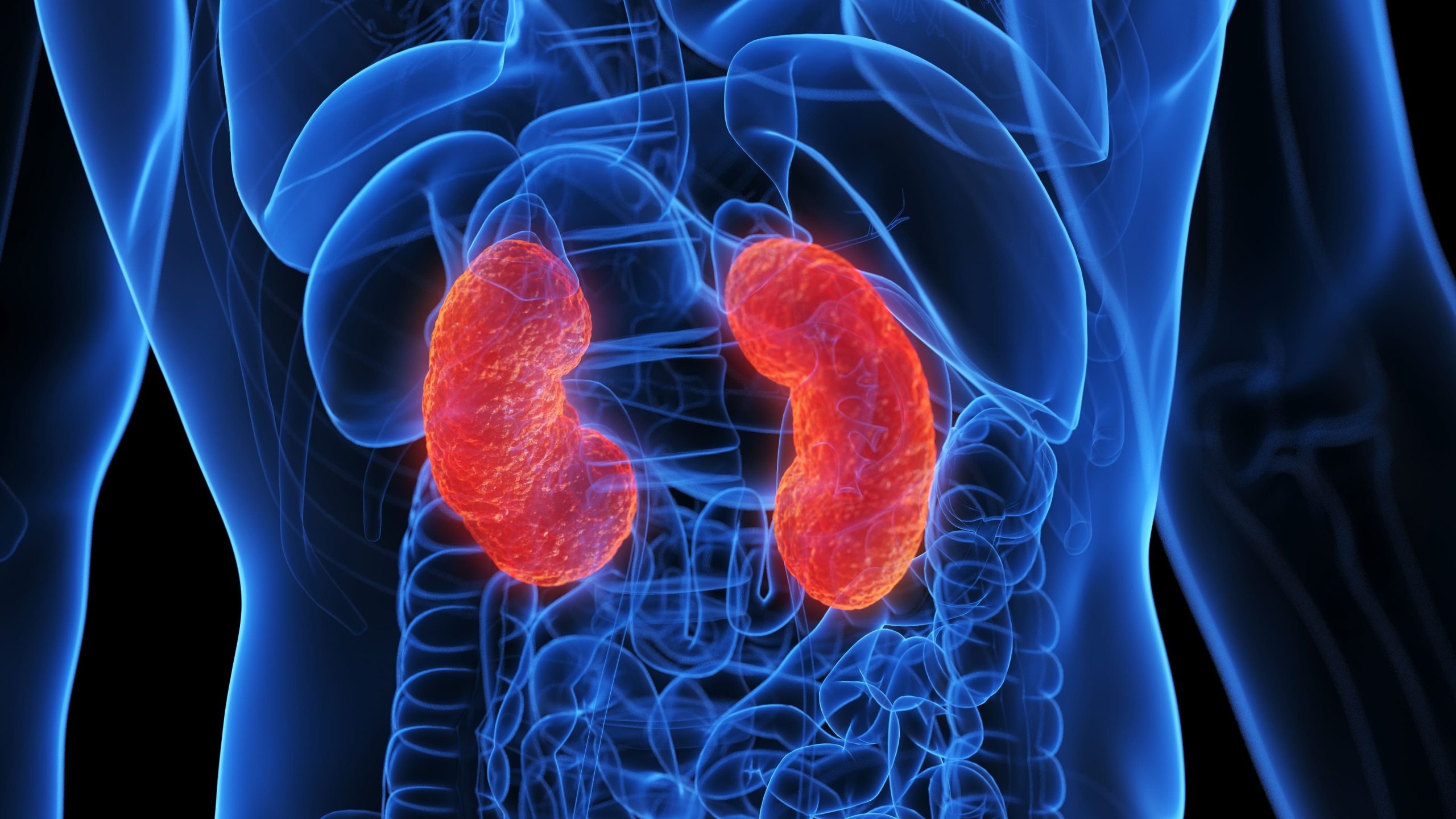 Acute Kidney Injury